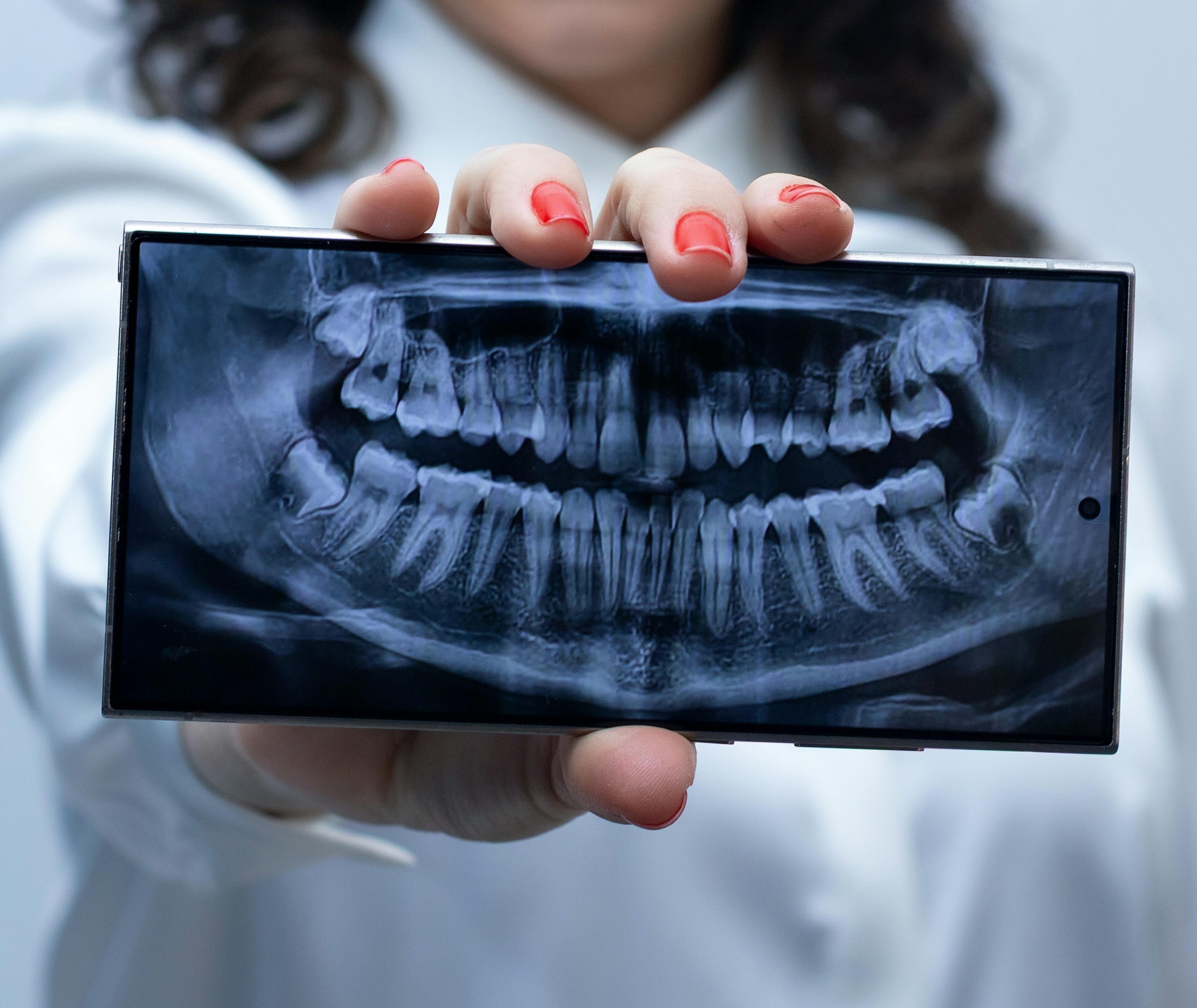 dentist holding up and showing a full-mouth x-ray