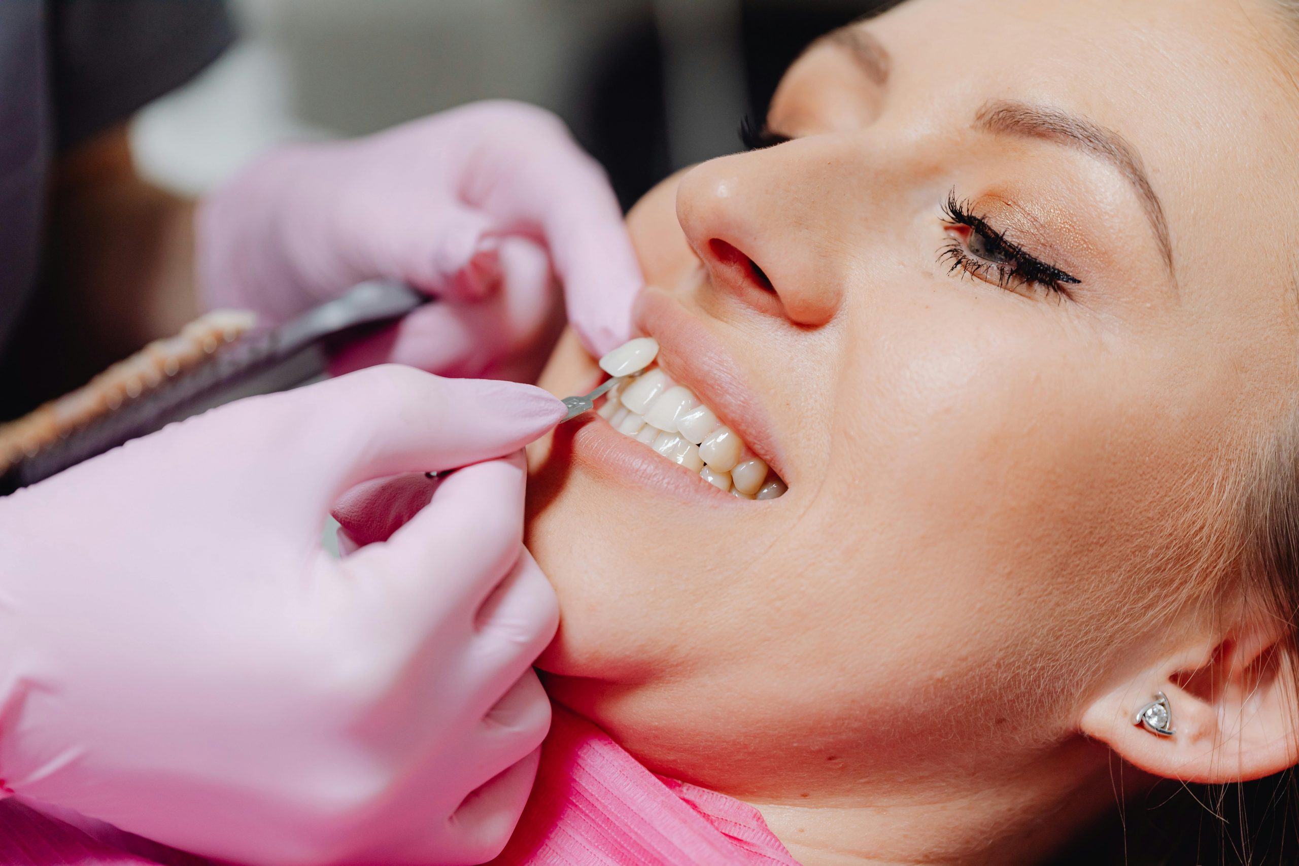 dentist trying a veneer sample on a patient in a dental chair